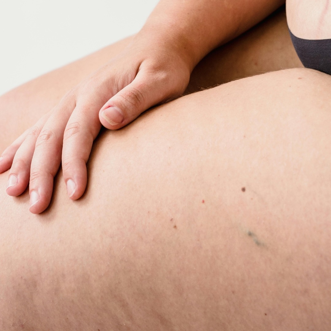 cuisses qui se touchent